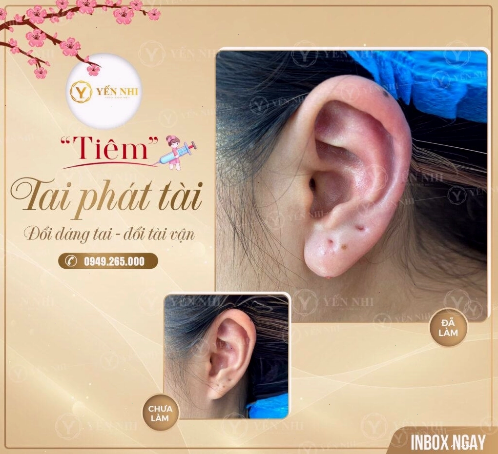 Phụ nữ có dái tai to, dày thường mang lại may mắn và tài lộc