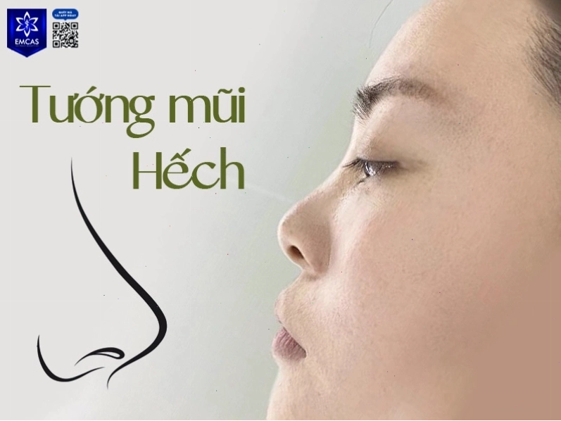 Phụ nữ có mũi hếch thường gặp khó khăn trong tình duyên