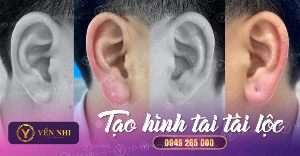 Phụ nữ có tướng tai dày dặn, vành tai rõ nét thường có cuộc sống giàu sang