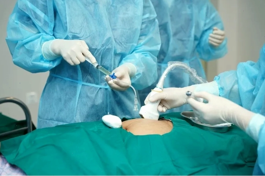 Quy trình chọc ối thường thực hiện từ tuần thai 16
