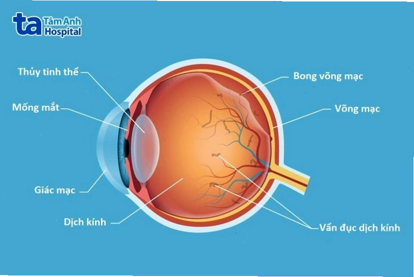 Sơ đồ minh họa vị trí và các lớp cấu tạo của võng mạc mắt
