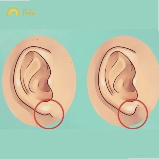 Tai trong nhân tướng học và ý nghĩa sức khỏe