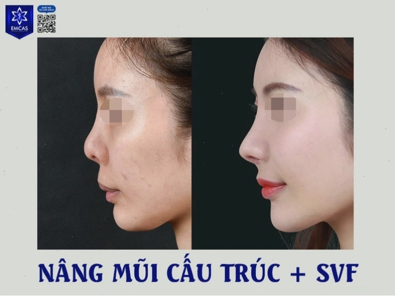 Tầm quan trọng của tướng mũi đối với vận mệnh tình duyên phụ nữ