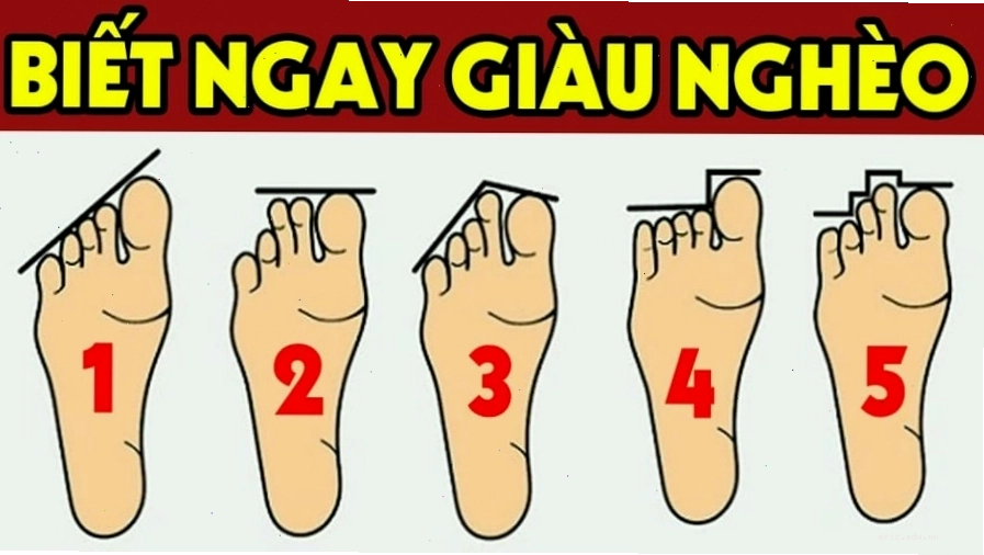 Tóm tắt ý nghĩa các tướng bàn chân và lời khuyên cải thiện