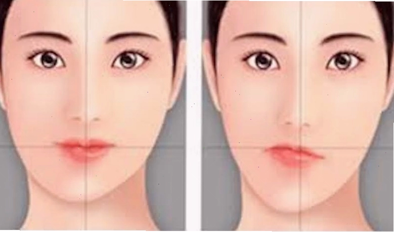 Tướng cằm lệch ở phụ nữ, ảnh hưởng đến sự hài hòa khuôn mặt và vận mệnh