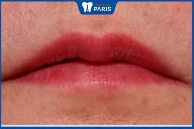 Tướng môi thuyền úp với khóe miệng trễ xuống, thể hiện sự buồn bã và vất vả