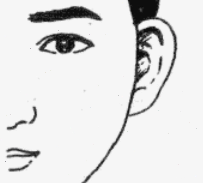 Tướng tai heo ở phụ nữ
