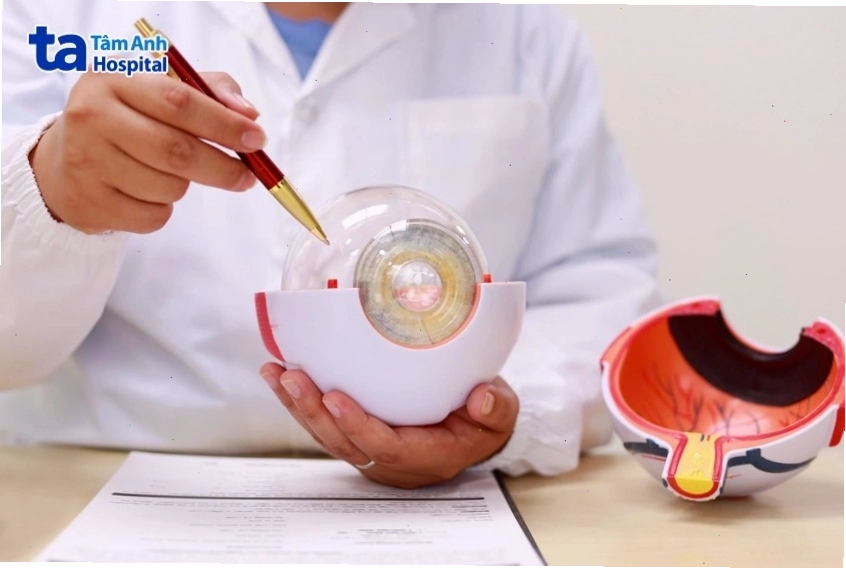 Vị trí của võng mạc nằm ở lớp trong cùng của thành nhãn cầu