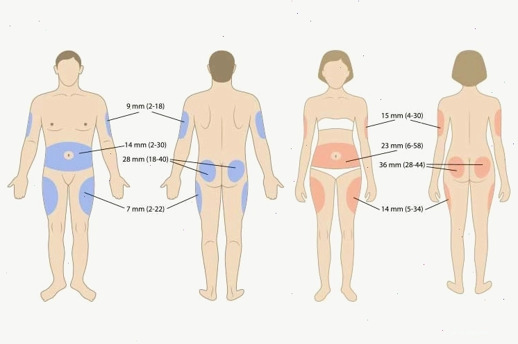 Vị trí tiêm insulin trên cơ thể