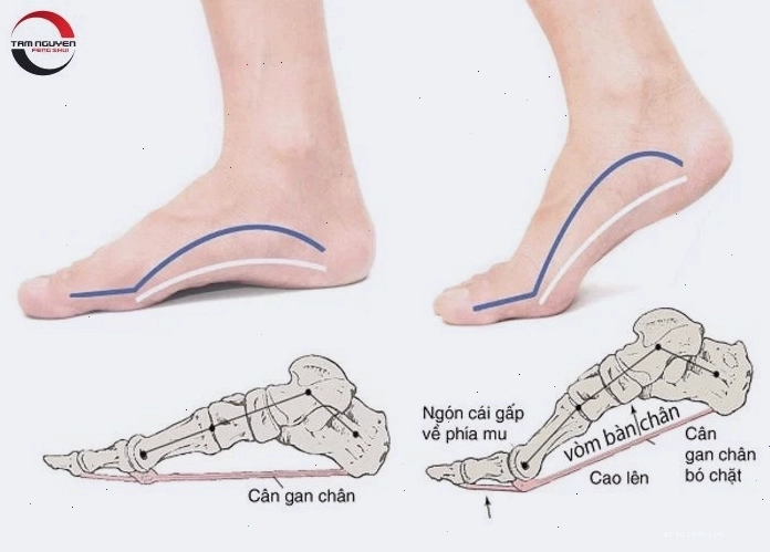 Xem tướng bàn chân nam giới qua gót chân và màu sắc da