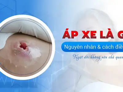 Áp xe là gì? Nguyên nhân, triệu chứng và cách phòng tránh