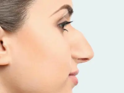 Nhận diện mũi gồ tướng số và ý nghĩa trong nhân tướng học