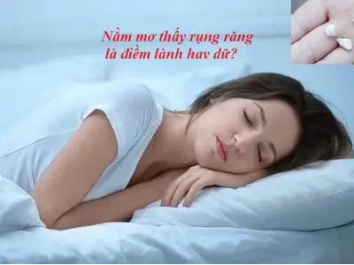 Giải mã nằm mơ gãy răng báo hiệu điều gì chính xác