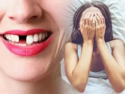 Nằm mơ gãy răng cửa là điềm gì và con số may mắn?