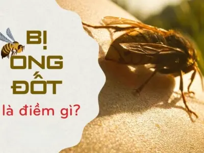 Nằm mơ ong đốt là điềm báo gì? Tốt hay xấu?