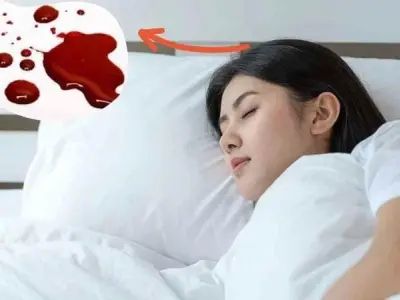 Nằm mơ thấy máu có liên quan đến vận mệnh không?