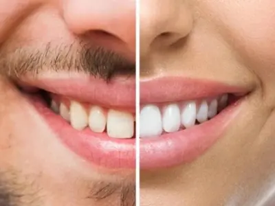 Luận giải nhân tướng học môi để hiểu rõ vận mệnh bản thân