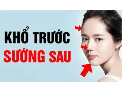 Tướng số người khổ trước sướng sau tiết lộ vận mệnh