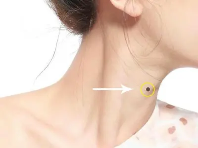 Tướng số nốt ruồi ở cổ tiết lộ vận mệnh và tài lộc