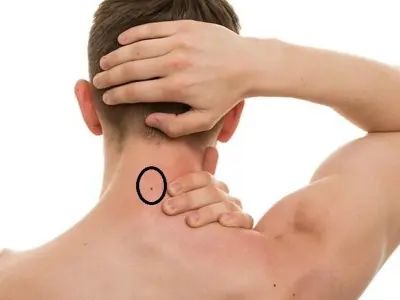 Tướng số nốt ruồi sau gáy và ý nghĩa phong thủy cuộc đời