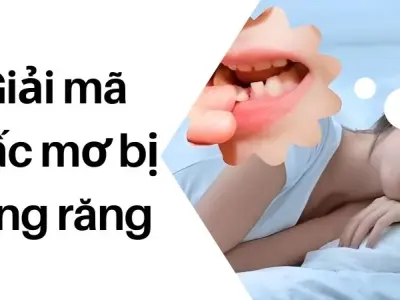 Giải mã giấc mơ bị rụng răng hé lộ điềm báo lạnh gáy