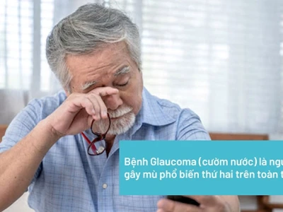Bệnh cườm nước là gì? Nguyên nhân, triệu chứng và cách điều trị hiệu quả