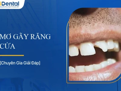 Mơ thấy gãy răng là điềm báo gì? Giải mã giấc mơ chi tiết