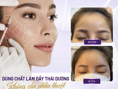 Thái Dương Hóp Tướng Số: Giải Mã Ý Nghĩa và Cách Cải Thiện Hiệu Quả