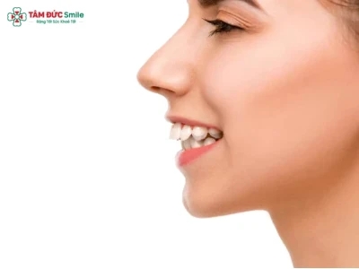 Tướng Phụ Nữ Răng Hô: Phân Tích Vận Mệnh, Tính Cách Và Cách Cải Thiện