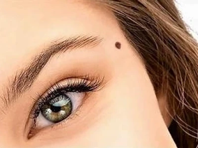 Xem Tướng Nốt Ruồi Trên Mặt Phụ Nữ: Ý Nghĩa Và Vị Trí Đắc Địa
